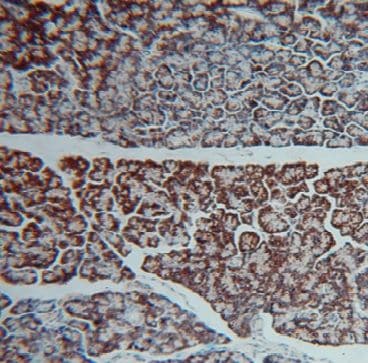 GCAT Antibody - BSA Free