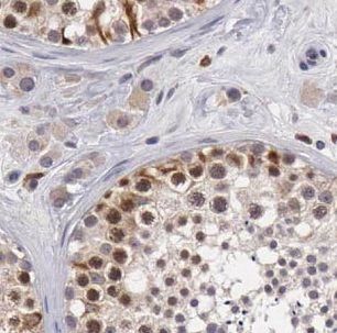 GBP6 Antibody - BSA Free