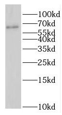 GAS8 Antibody - BSA Free
