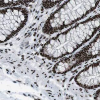 NOLA1 Antibody - BSA Free