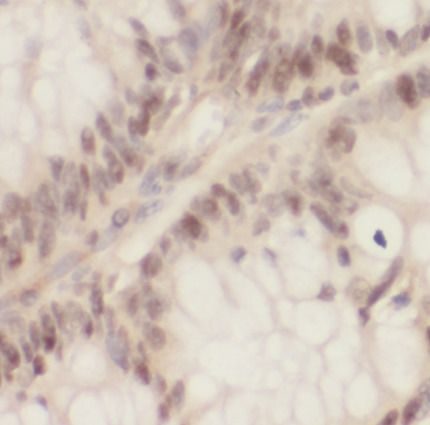 MCM3AP Antibody - BSA Free