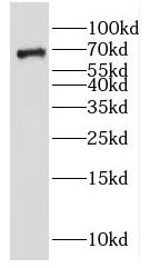 GALNT9 Antibody - BSA Free