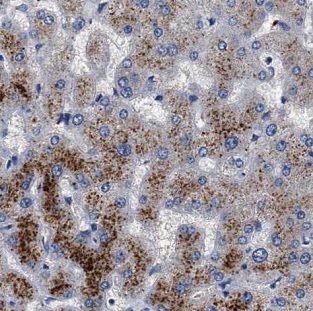 G6PC3 Antibody - BSA Free