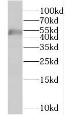 FYTTD1 Antibody - BSA Free