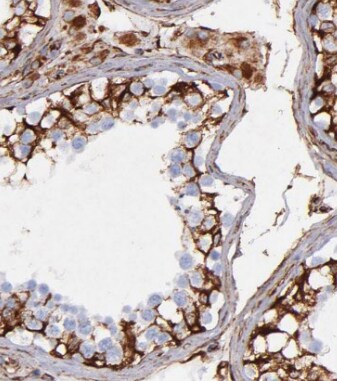 FXYD4 Antibody - BSA Free