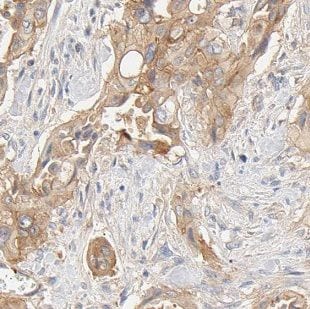 FXYD2 Antibody - BSA Free