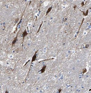 FSD1L Antibody - BSA Free