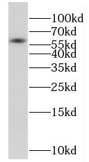 FSD1L Antibody - BSA Free