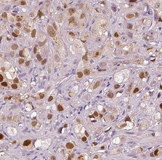 FSCN3 Antibody - BSA Free