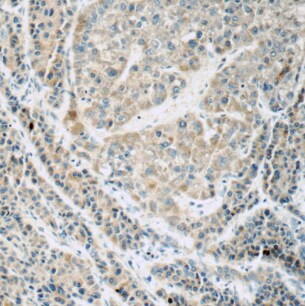 QBRICK/FREM1 Antibody - BSA Free