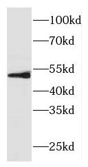 FOXRED1 Antibody - BSA Free