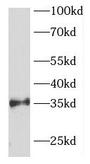 FOXR1 Antibody - BSA Free