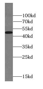 FOXD4L6 Antibody - BSA Free
