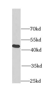 FIBP Antibody - BSA Free