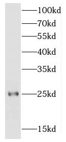FGFR1OP2 Antibody - BSA Free