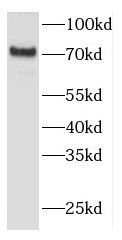 FEM1A Antibody - BSA Free