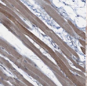 FEM1A Antibody - BSA Free
