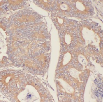 FBXW2 Antibody - BSA Free