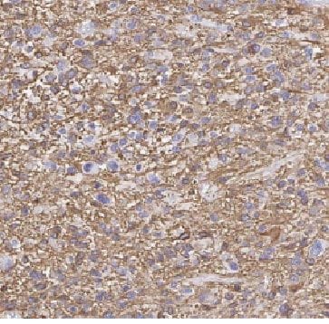 FBXO6 Antibody - BSA Free