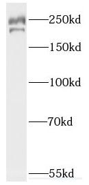 FANCM Antibody - BSA Free