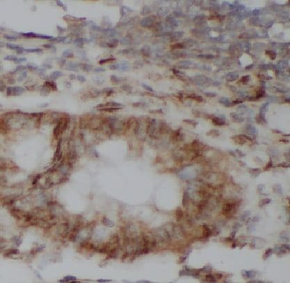 KRT81 Antibody - BSA Free