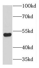 KRT80 Antibody - BSA Free