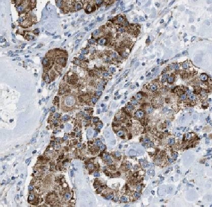 KRT80 Antibody - BSA Free