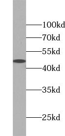 KRT40 Antibody - BSA Free