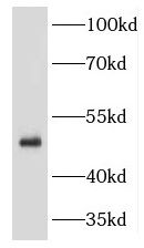 KRT34 Antibody - BSA Free