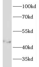 KRTHA3B Antibody - BSA Free