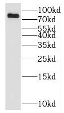 KLHL9 Antibody - BSA Free