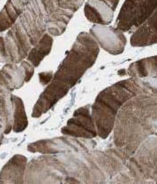 KLHL31 Antibody - BSA Free