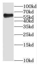 KLHL31 Antibody - BSA Free