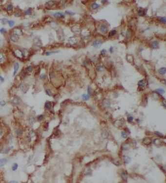 KLHL29 Antibody - BSA Free