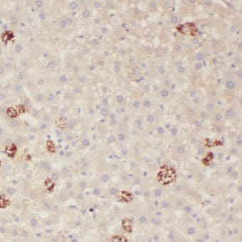 KLHL28 Antibody - BSA Free