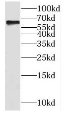 KLHL28 Antibody - BSA Free