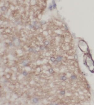 Kelch-Like Family Member 21 Antibody - BSA Free