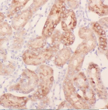 KLHL20 Antibody - BSA Free