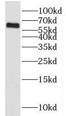 KLHL18 Antibody - BSA Free