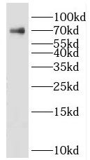 KLHL15 Antibody - BSA Free