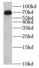 KLHL13 Antibody - BSA Free