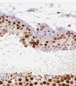 KLHDC3 Antibody - BSA Free