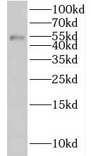 KLHDC3 Antibody - BSA Free