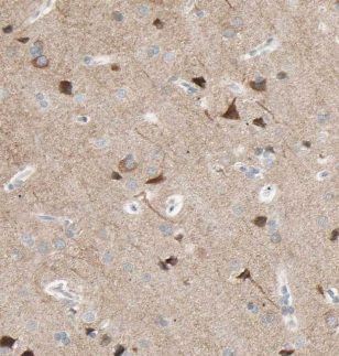 KLC2 Antibody - BSA Free