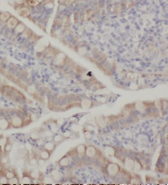 KCNJ13 Antibody - BSA Free