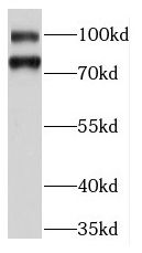 KIFC3 Antibody - BSA Free