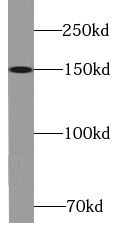 KIF7 Antibody - BSA Free