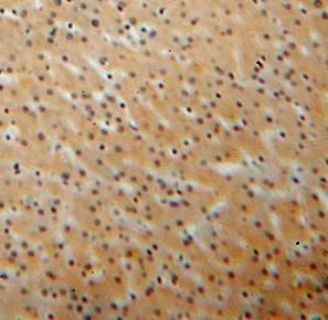KIF6 Antibody - BSA Free