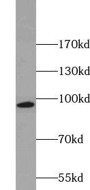 KIF6 Antibody - BSA Free