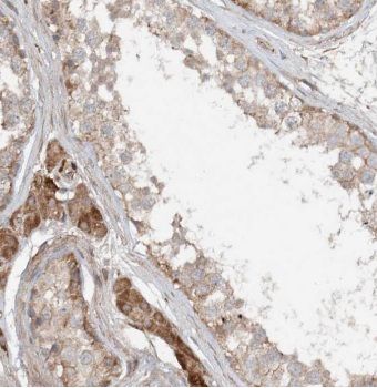 Kinesin 5C Antibody - BSA Free